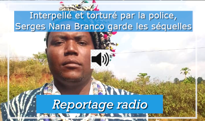 Interpellé et torturé pendant sa détention, Serges Branco Nana garde les séquelles